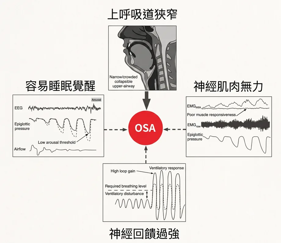 阻塞型睡眠呼吸中止症機轉示意